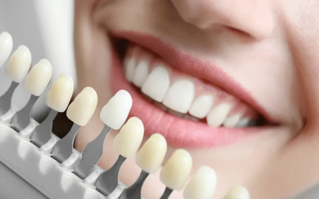 Wybielanie zębów u stomatologa w Radomiu